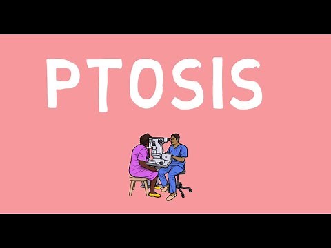 Ptosis- myogenic, neurogenic, congenital and involutional causes