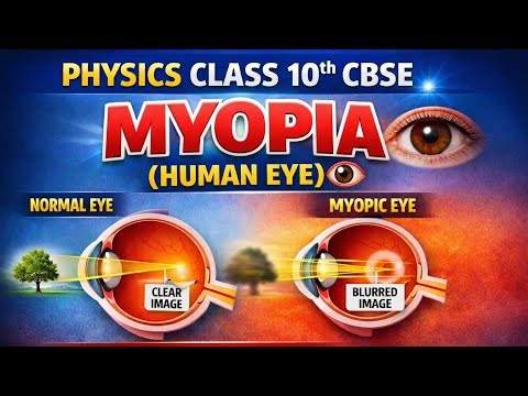 MYOPIA HUMAN EYE CLASS 10TH CBSE BOARD EXAM causes and correction #physics #10thclass #myopia