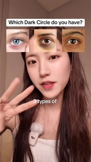 Which dark circle do you have?