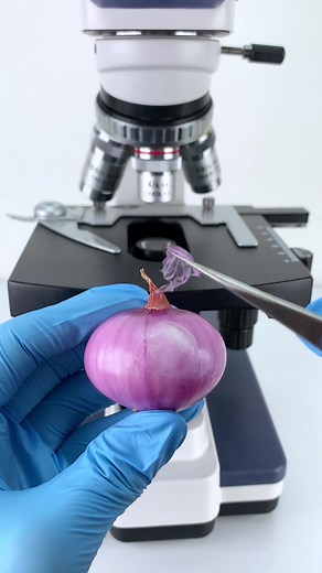Exploring the Fascinating World of Onions at 400x Magnification!