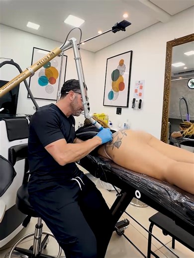 Primeira sessão de remoção da @vickmoranguinhoo0, que tem essa tatuagem em preto localizada na região do glúteo. E quem acompanhava a gente durante o procedimento era ele, o próprio: @pistolinhaofcc 🔫 Nesta sessão, falamos bastante sobre dor, um dos temas que mais gera dúvidas. E a verdade é que a percepção de dor na remoção é individual e varia de acordo com alguns fatores importantes: sensibilidade do paciente, extensão da tatuagem e local anatômico. Porém, na Hell Tattoo, utilizamos protocol
