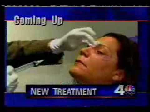 Botox Injections Can Cure Puffy Eyes