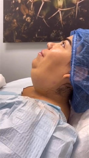 Learn About Double Chin Removal Approaches | WayRight Info