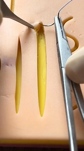 Running subcuticular suture (part 1) | Dermhacks