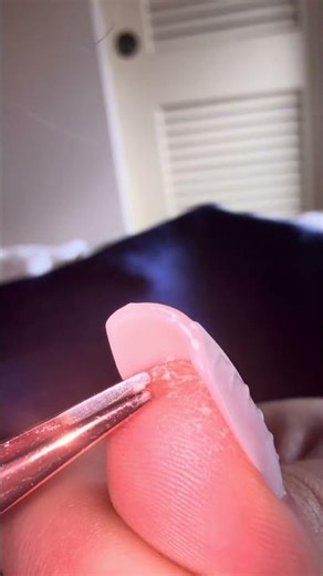 thumb skin picking #asmr #skinpicking #dandruff #fypシ