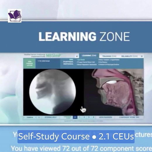 46 reactions | MBSImP™ Standardized Training & Reliability Testing | Northern Speech Services | Facebook