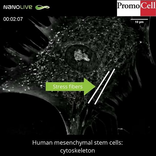 Label-free live cell imaging of Human Mesenchymal Stem Cells in vivo: The Cytoskeleton