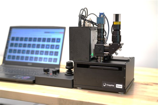 Affordable microscope speeds up malaria diagnosis with AI