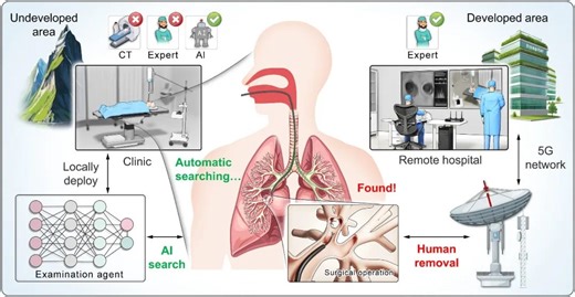 AI Bronchoscopy Robot for Remote Emergency Rescue
