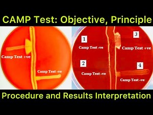 What is CAMP Test: A Biochemical Test for Identification of Group B Hemolytic Streptococcus Species