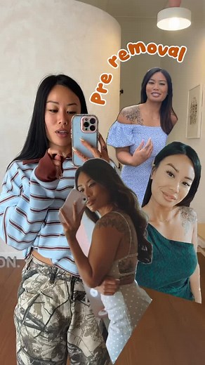 홂홪홮홨 홄 홣홚홚홙 홮홤홪홧 홝홚홡홥. Do I start removing the crane or leave it? Am I doing the most or should I chill and slow down with all this tattoo removal lel ☻ Comment below ☟ | Backspace Laser | Facebook