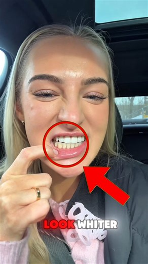 She Put Nail Polish On Her Teeth Before A Wedding 😬💍