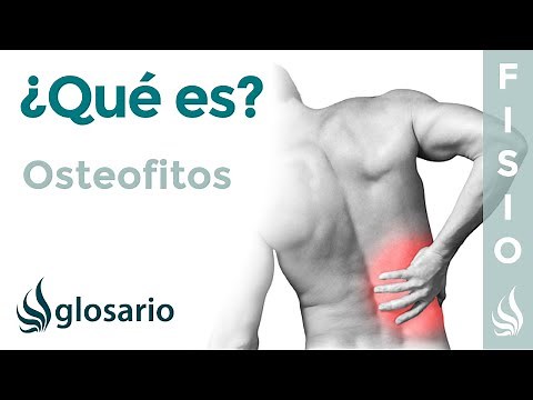 OSTEOFITOS | Qué es, qué afecta, síntomas, signos clínicos, causas y tratamiento fisioterapéutico