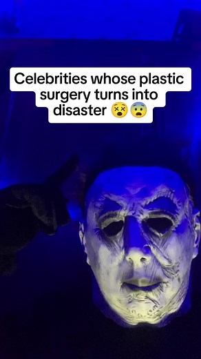 Celebrity Plastic Surgery Disasters: Shocking Transformations