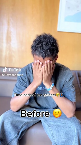 Talooyin Ku Saabsan Timo Cadaadka iyo Qaleelka