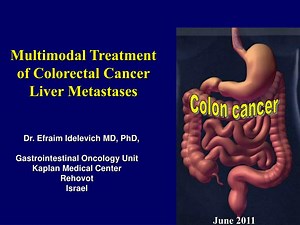 Colon cancer - SlideServe