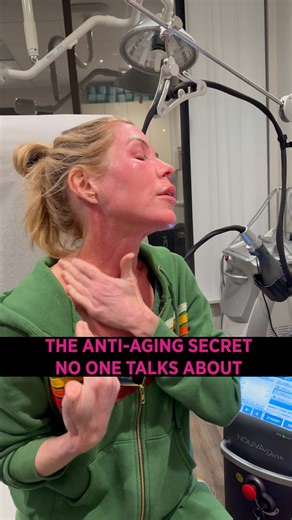 Consistency is key! Microneedling four times a year with laser added every other session. This combination stimulates collagen, improves skin quality, and delivers results that actually compound over time. It’s never too late to start!