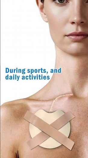 Protect your port now with Chemo Port Cover