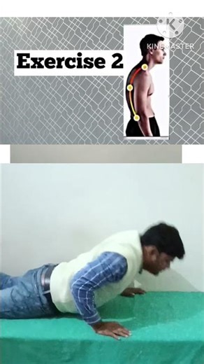 Goodbye Hunchback: Best Exercises for Kyphosis