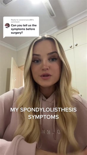 Understanding Spondylolisthesis: Symptoms and Recovery Experience