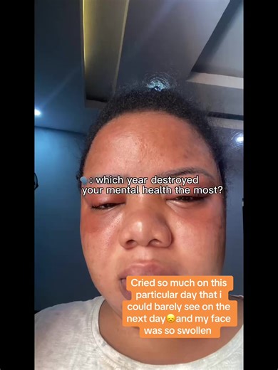 Coping with Emotional Pain and Swelling