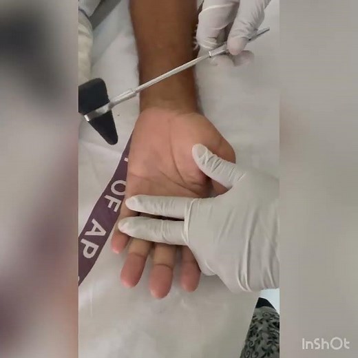 Finger Flexion reflex