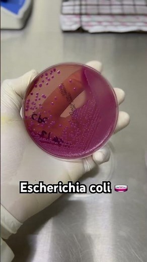 Escherichia coli 🧫🧫🧫 #Bacteriologia #microbiología