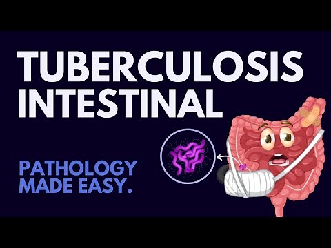 Intestinal Tuberculosis in 7 mins! l Pathology Made Easy