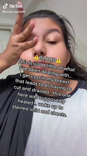 These past few weeks have been stressful ! | cyst