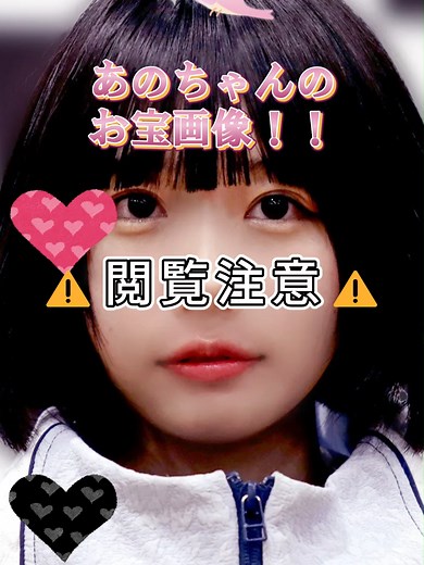あのちゃんのピタ止めチャレンジ画像集