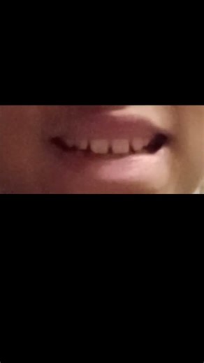 the difference between a camera smile and a real smile #nationalsmilemonth #smilepower #smilemore