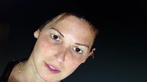 See How the Vectra 3D Works for Facial Analysis