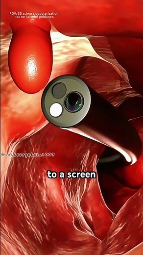 Colonoscopy procedure (3D animation) #medical3danimation #gastroenterology #3dmodeling #science