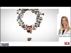 Definity Cervical Dilator – Animation