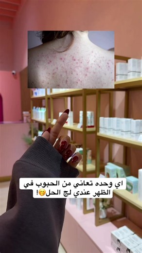 افضل غسول معالج للحبوب في الجسم panoxyl🧖🏻‍♀️✅ #عناية #حب_الشباب #بانوكسيل #acne #panoxyl