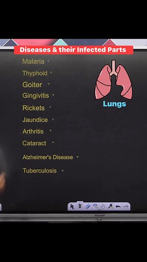 263K views · 4.5K reactions |  Diseases & their Infected Parts 贈樂 !! #diseases #infectedparts #malaria #Typhoid #tuberculosis #biology #sciencefacts #education #knowledge #exams #NEET #UPSC #study #knowledgeispower #facts #facebookreelsviral #fbreelsvideo #facebookreelsvideo #fbreelsviral #facebookreels #reelsfb #reelsviral | Krishna Thakur | Facebook