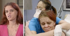 'Dr Pimple Popper': Brittany seeks Dr Lee's help after being called 'monster' for bumps on body