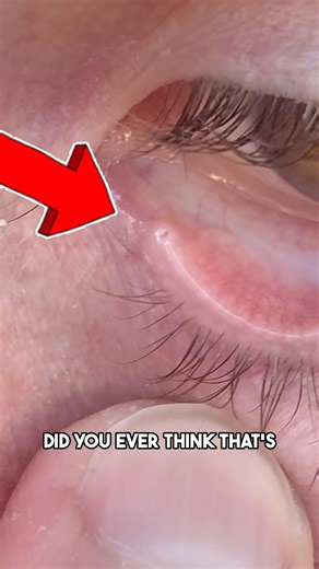 Why your nose runs when you cry 😭