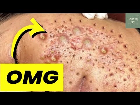 You’ve Never Seen Pops Like This Before!