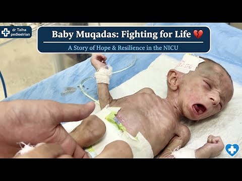 Fragile Baby Muqadas Update 💔| Short Gut Syndrome & Recovery Journey ❤️