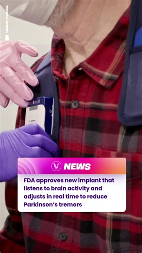 VivaTech | FDA approves Medtronic’s BrainSense implant to fight Parkinson’s tremors 🧠 The device can detect the brain activity that triggers tremors... | Instagram