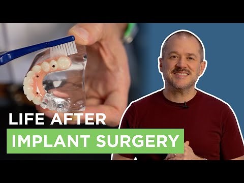 What To Actually Expect After Dental Implant Surgery | Recovery Tips