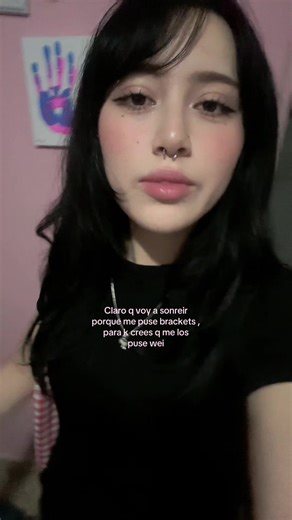 odiaba mis dientes y ahorita también pero al menos ya se ben mas chidos con los alambres ai