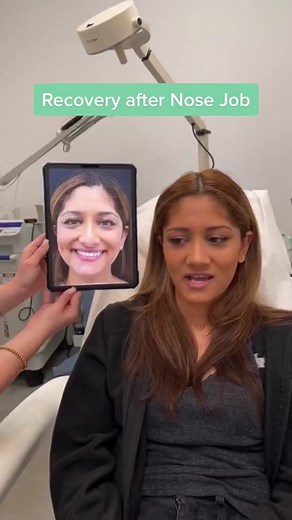 How is recovery like after nose job #plasticsurgery #nycplasticsurgeon #njplasticsurgeon #losangelesplasticsurgeon #entdoctor #dubaiplasticsurgery #rhinoplastybeforeandafter #nosejobbeforeandafter #rhinoplastyturkey #rhinoplastyjourney #rhinoplastyspecialist #rhinoplastysurgery #nosejobsurgery #nosejobrecovery #nosejobcheck #bestplasticsurgeon #bestplasticsurgery #bestnosejob #fyp #viral #nyc #ethnicrhinoplasty #ethnicnosejob #nosejobistanbul #rhinoplastyistanbul