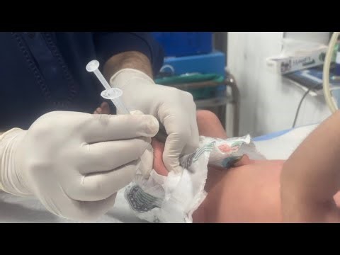 Vitamin K Injection for Newborn | When to Start First Formula Milk? | Baby Sucking Guide