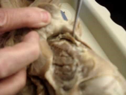 Cat Dissection (scalenius medius, transverse costarum)