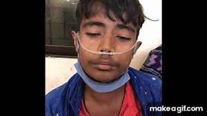 de Musset’s sign & Corrigan’s sign on Make a GIF