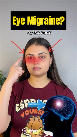 ✅Placing your thumbs at the corner of your eye sockets and pressing gently upward while inhaling and exhaling stimulates the supraorbital and supratrochlear nerves, which carry pain signals from the forehead and eyes. ✅This pressure helps calm overactive nerves, reduce vascular dilation, and synchronize with slow breathing to activate the parasympathetic nervous system, promoting relaxation and pain relief. ✅After static pressure, using gentle circular motions increases blood and lymphatic circu