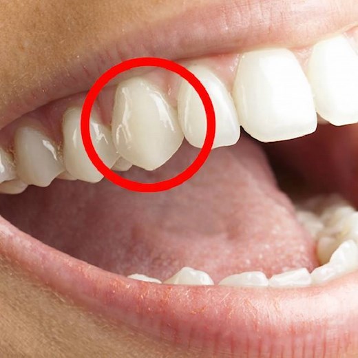 669K views · 479 reactions | This is the real reason why humans have sharp front teeth. | Insider Science | Facebook