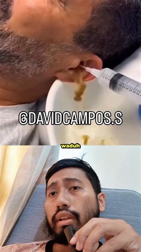 bilas T41 KUPING ⁉️😱 bolehkah dok #faktakesehatan #faktaunik #drbimo